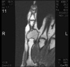 Zoom image: Radiological image