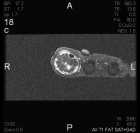 Zoom image: Radiological image