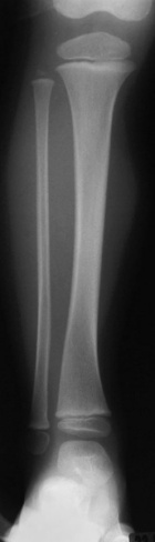 Zoom image: Radiological image