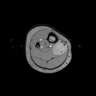Zoom image: Radiological image