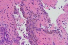 Zoom image: Cell stain