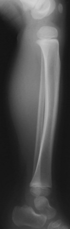 Zoom image: Radiological image