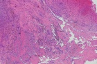 Zoom image: Cell stain
