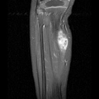 Zoom image: Radiological image