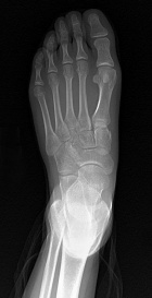 Zoom image: Radiological image