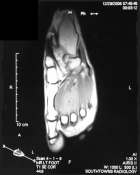 Zoom image: Radiological image