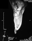 Zoom image: Radiological image