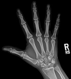 Zoom image: Radiological image