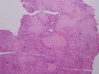 Zoom image: Cell stain
