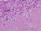 Zoom image: Cell stain