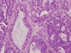 Zoom image: Cell stain