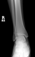 Zoom image: Radiological image