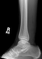 Zoom image: Radiological image