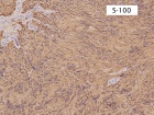 Zoom image: Cell stain