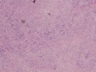 Zoom image: Cell stain