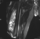 Zoom image: Radiological image