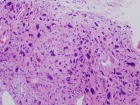 Zoom image: Cell stain