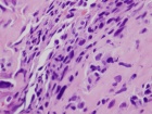 Zoom image: Cell stain