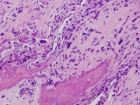 Zoom image: Cell stain