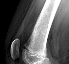 Zoom image: Radiological image