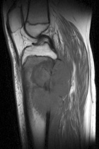 Zoom image: Radiological image