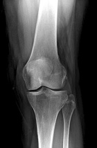 Zoom image: Radiological image