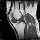 Zoom image: Radiological image