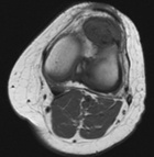 Zoom image: Radiological image