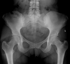 Zoom image: Radiological image