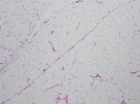 Zoom image: Cell stain