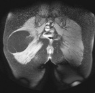 Zoom image: Radiological image