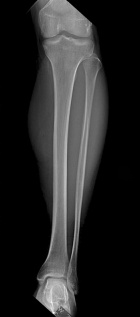 Zoom image: Radiological image