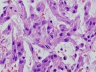 Zoom image: Cell stain