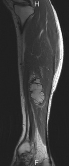 Zoom image: Radiological image