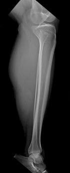 Zoom image: Radiological image