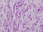 Zoom image: Cell stain
