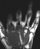 Zoom image: Radiological image