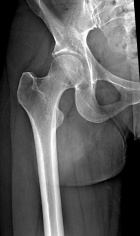 Zoom image: Radiological image