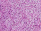 Zoom image: Cell stain