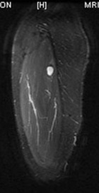 Zoom image: Radiological image