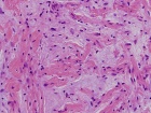 Zoom image: Cell stain