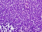Zoom image: Cell stain
