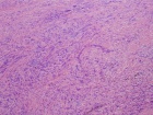 Zoom image: Cell stain
