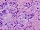 Zoom image: Cell stain