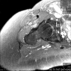 Zoom image: Radiological image