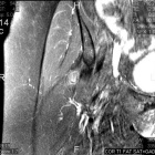 Zoom image: Radiological image