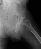 Zoom image: Radiological image