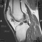 Zoom image: Radiological image