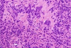 Zoom image: Cell stain