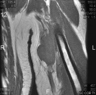 Zoom image: Radiological image